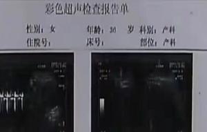 陕西37岁不孕女子突然怀孕，5个月后胎儿&amp;quot;消失&amp;quot;,检查结果吓坏医生  第13张