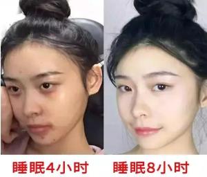 49岁李嘉欣才是真的&amp;amp;quot;睡美人&amp;amp;quot;！晚上10点就睡觉，睡眠质量好到爆  第18张