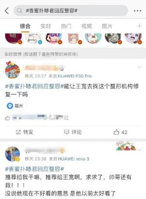 真替这5位明星喘不上来气，明明原生脸也不丑，偏要跟鼻子过不去  第35张